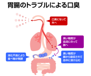 livejupiter 1614700015 2901 300x249 - 【悩み】 好きな人の口臭を注意する方法