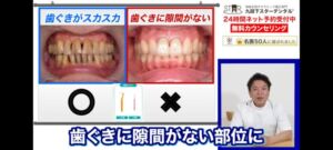 livegalileo 1746938971 101 300x135 - 【衝撃】 歯科医師「フロスや歯間ブラシは絶対に使うな！」