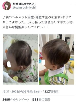 livegalileo 1753603025 101 300x404 - 【画像】 親ガチャ成功の赤ちゃん、見つかるｗｗｗｗｗ